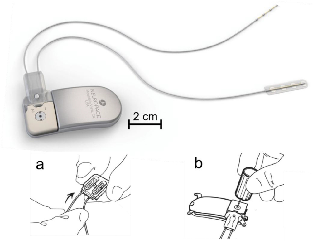 Interfixated Device Electrical connectors for neural implants: design, state of the art and ...