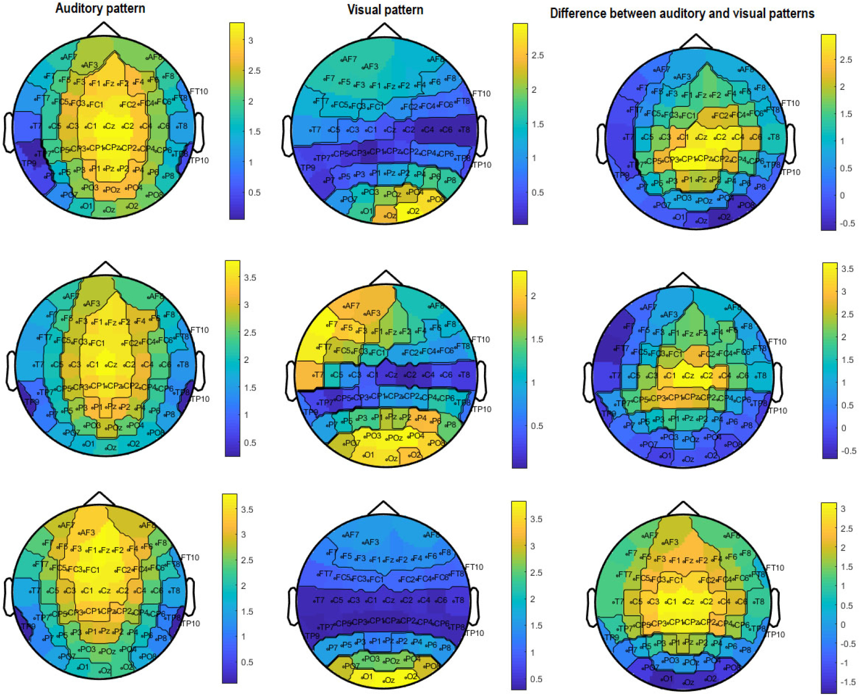 Real-time monitoring and regulating auditory cortex alpha activity in ...