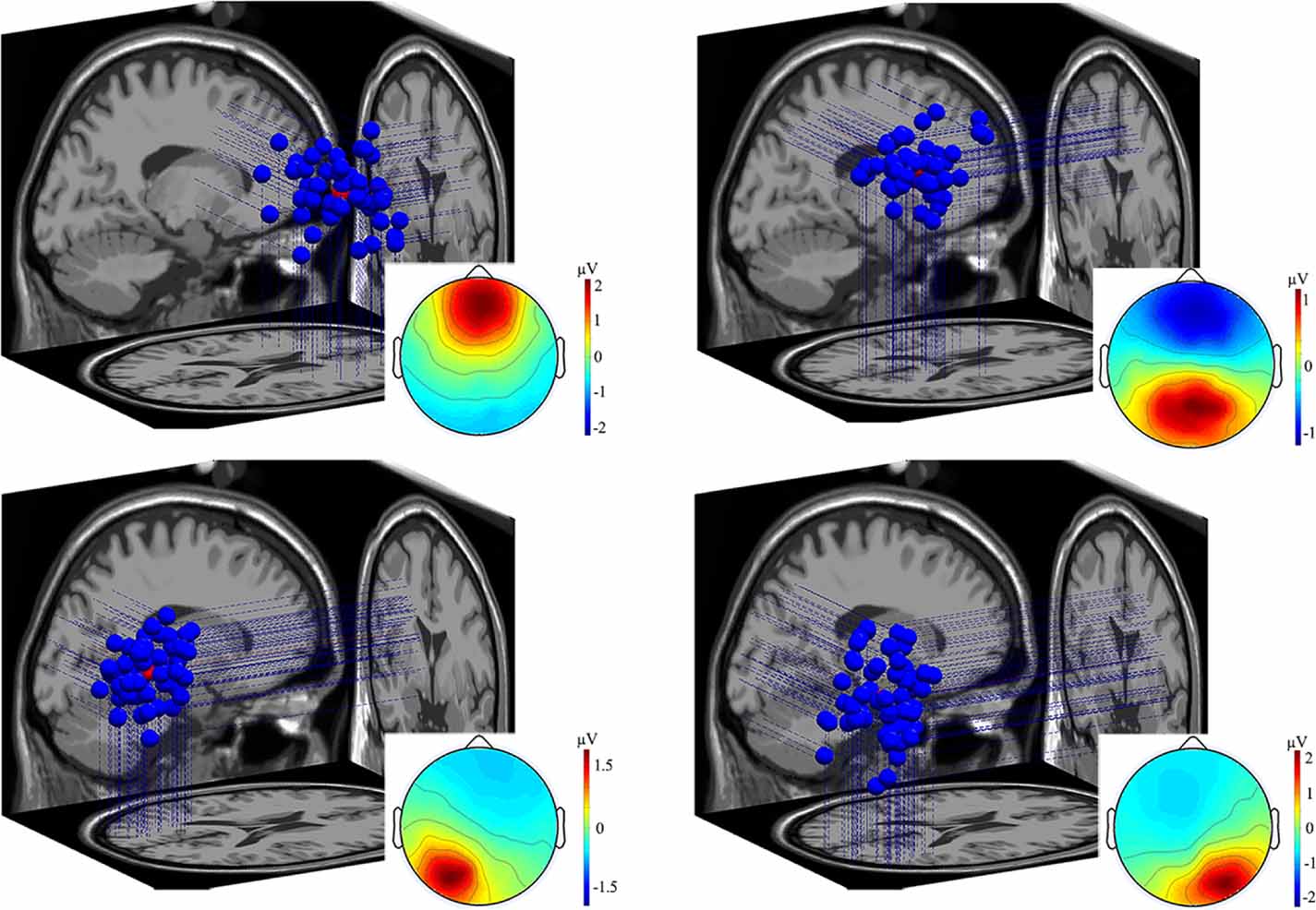 Spatiotemporal dynamics of working memory under the influence of ...