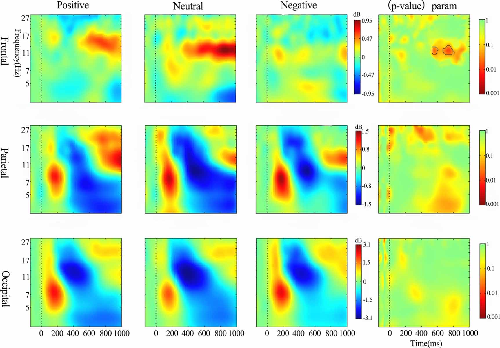 Spatiotemporal dynamics of working memory under the influence of ...