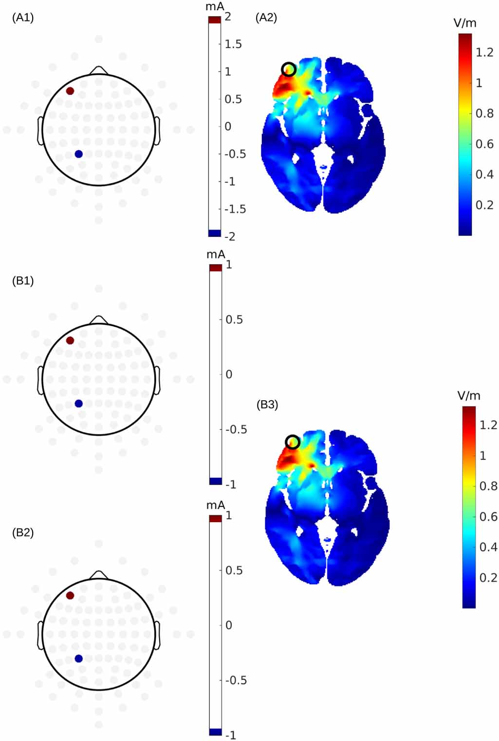 Optimization of interferential stimulation of the human brain with ...