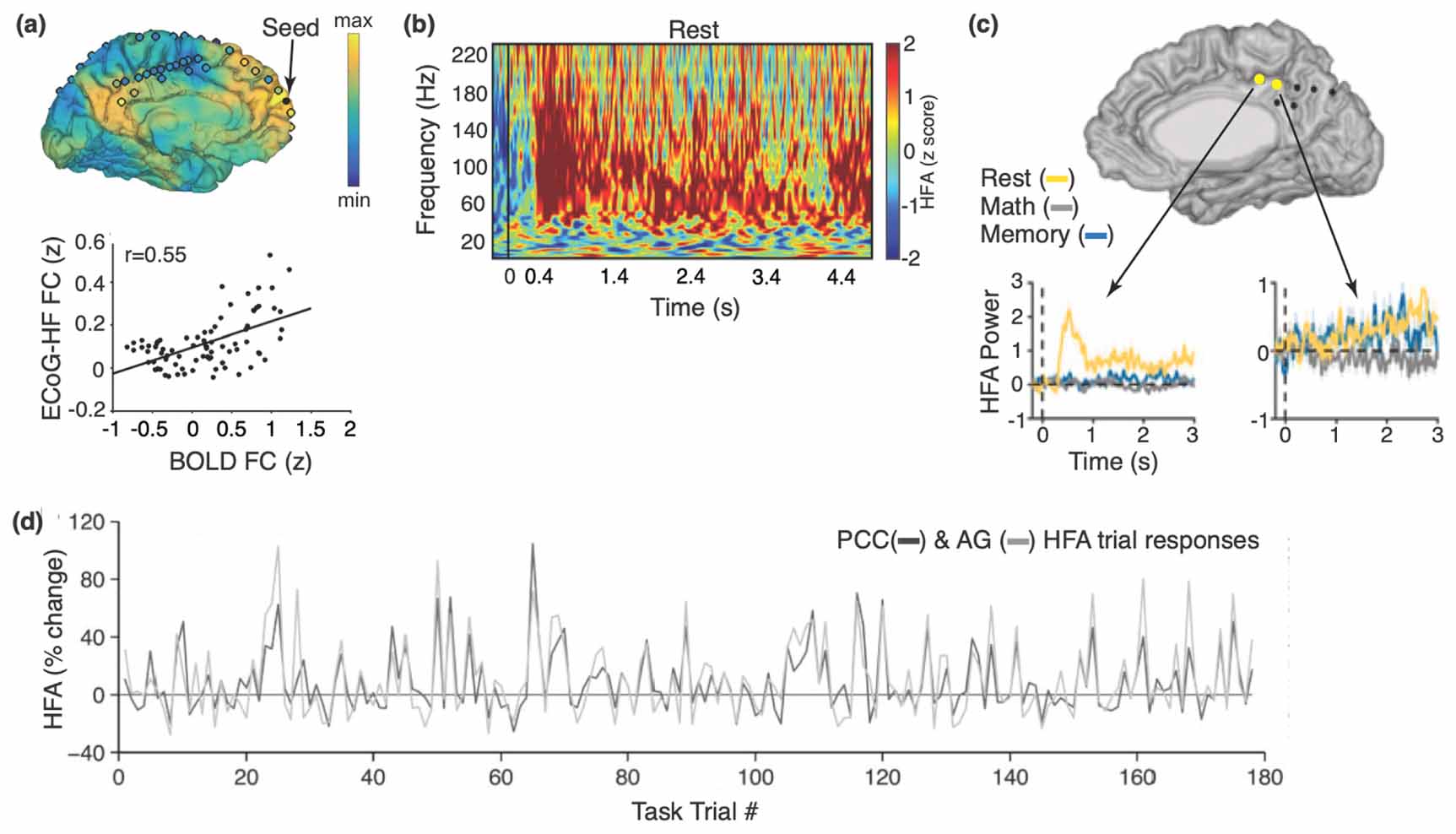 Insights into human cognition from intracranial EEG: A review of ...