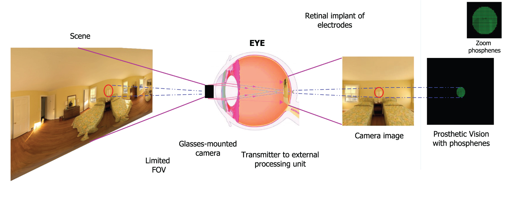 Influence of field of view in visual prostheses design: Analysis with a ...