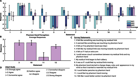 Phantom Sense Sensory stimulation enhances phantom limb perception and movement ...