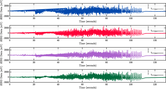 Fractional-order model predictive control as a framework for electrical ...