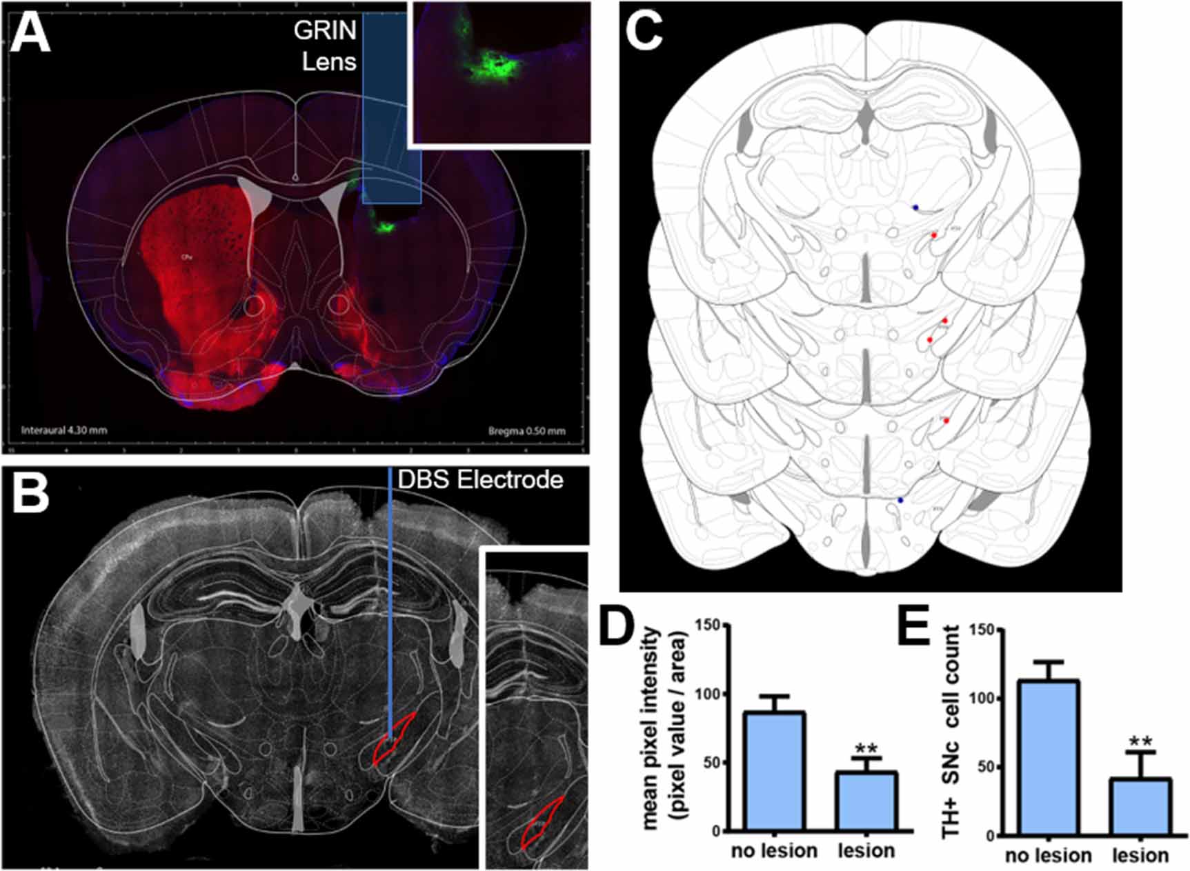 Calcium imaging in freely moving mice during electrical stimulation of ...