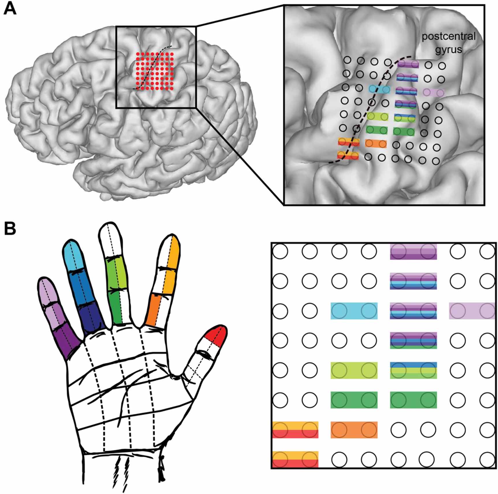 Mapping of primary somatosensory cortex of the hand area using a high ...