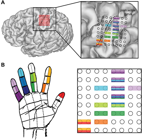 Mapping of primary somatosensory cortex of the hand area using a high ...