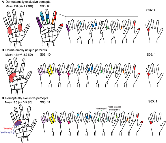 Mapping of primary somatosensory cortex of the hand area using a high ...