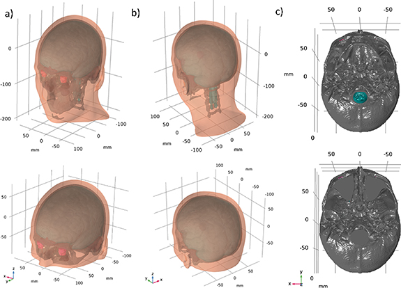 A comprehensive analysis of the impact of head model extent on electric ...