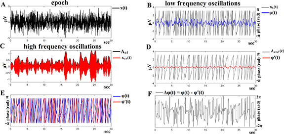 An automatic sleep disorder detection based on EEG cross-frequency ...
