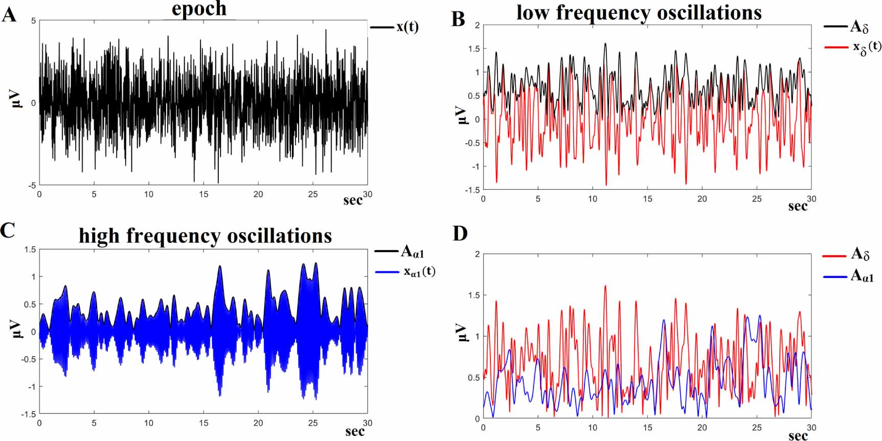 An automatic sleep disorder detection based on EEG cross-frequency ...