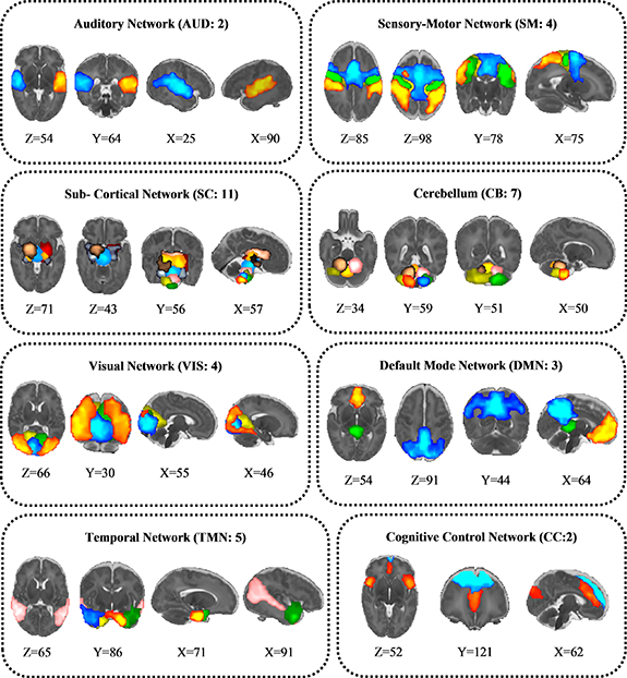 Multi-scale structural rich-club organization of the brain in full-term ...