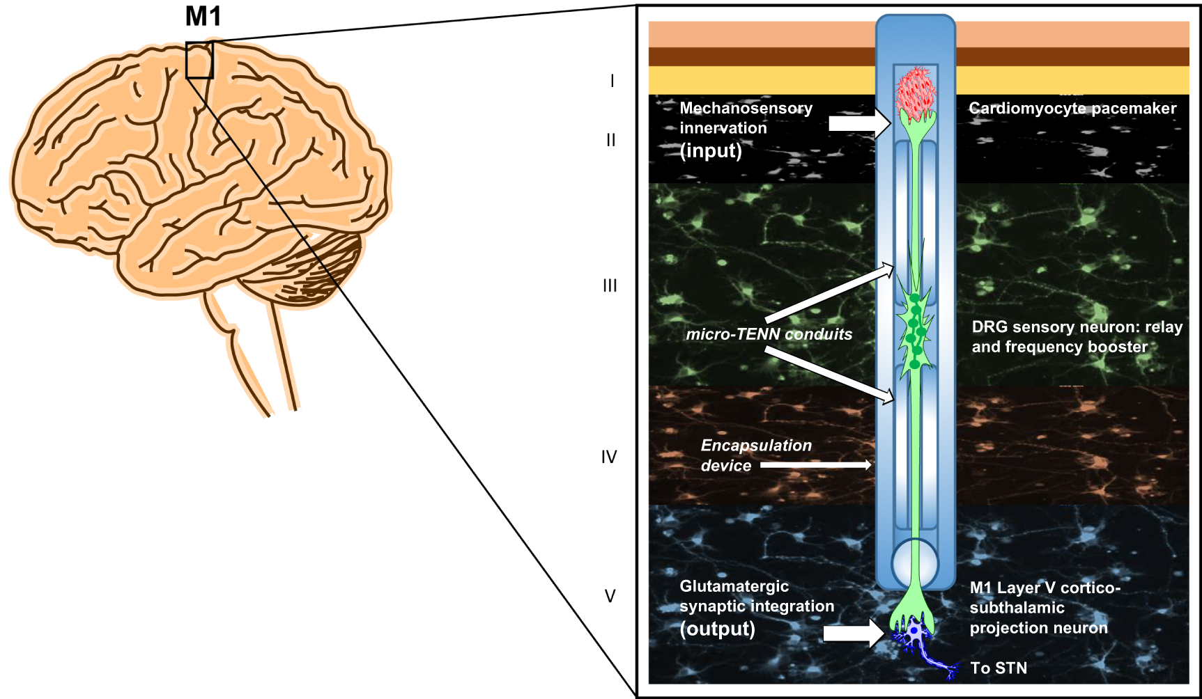 Toward living neuroprosthetics: developing a biological brain pacemaker ...
