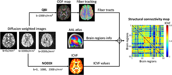 White matter structural connectivity as a biomarker for detecting ...