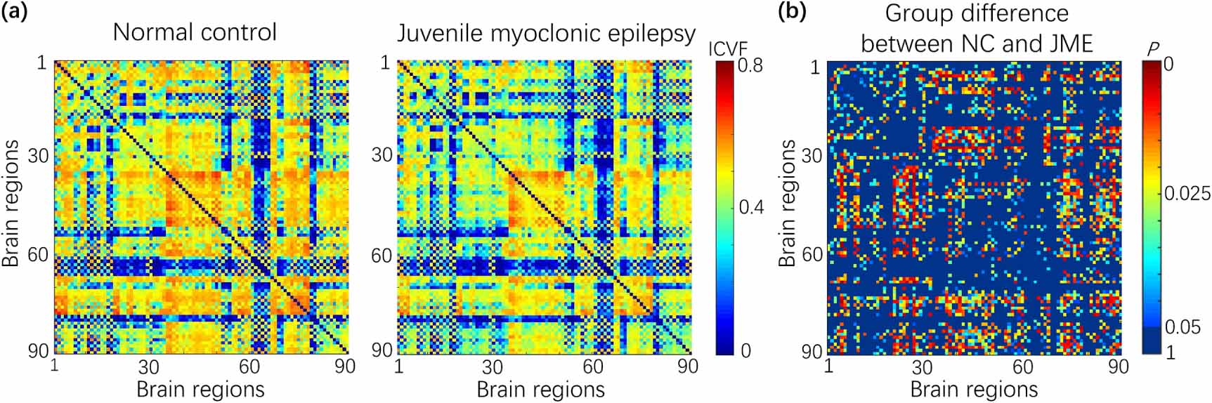 White matter structural connectivity as a biomarker for detecting ...