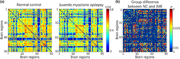 White matter structural connectivity as a biomarker for detecting ...