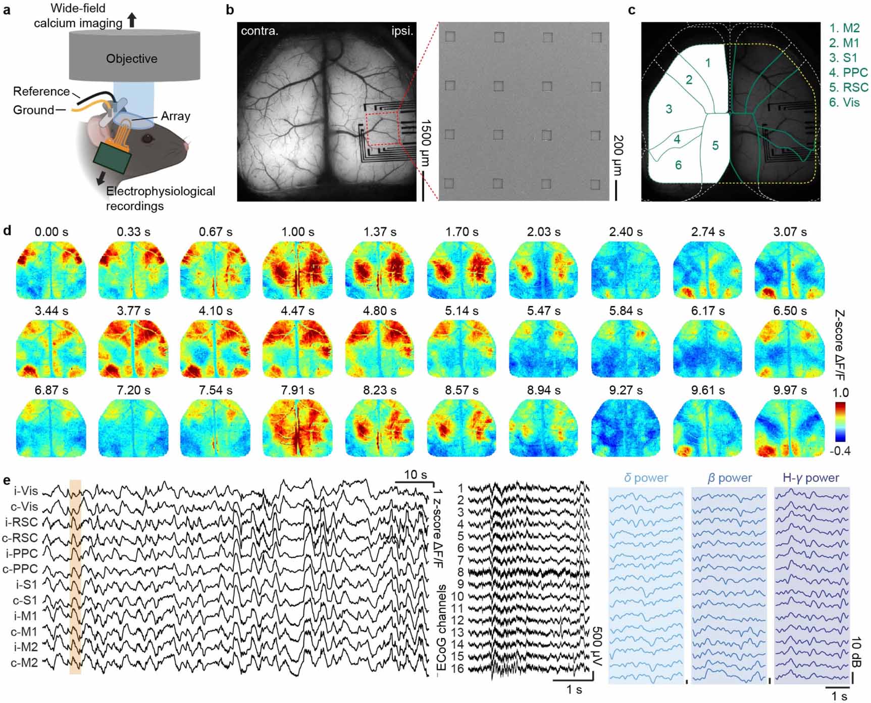 Decoding of cortex-wide brain activity from local recordings of neural ...
