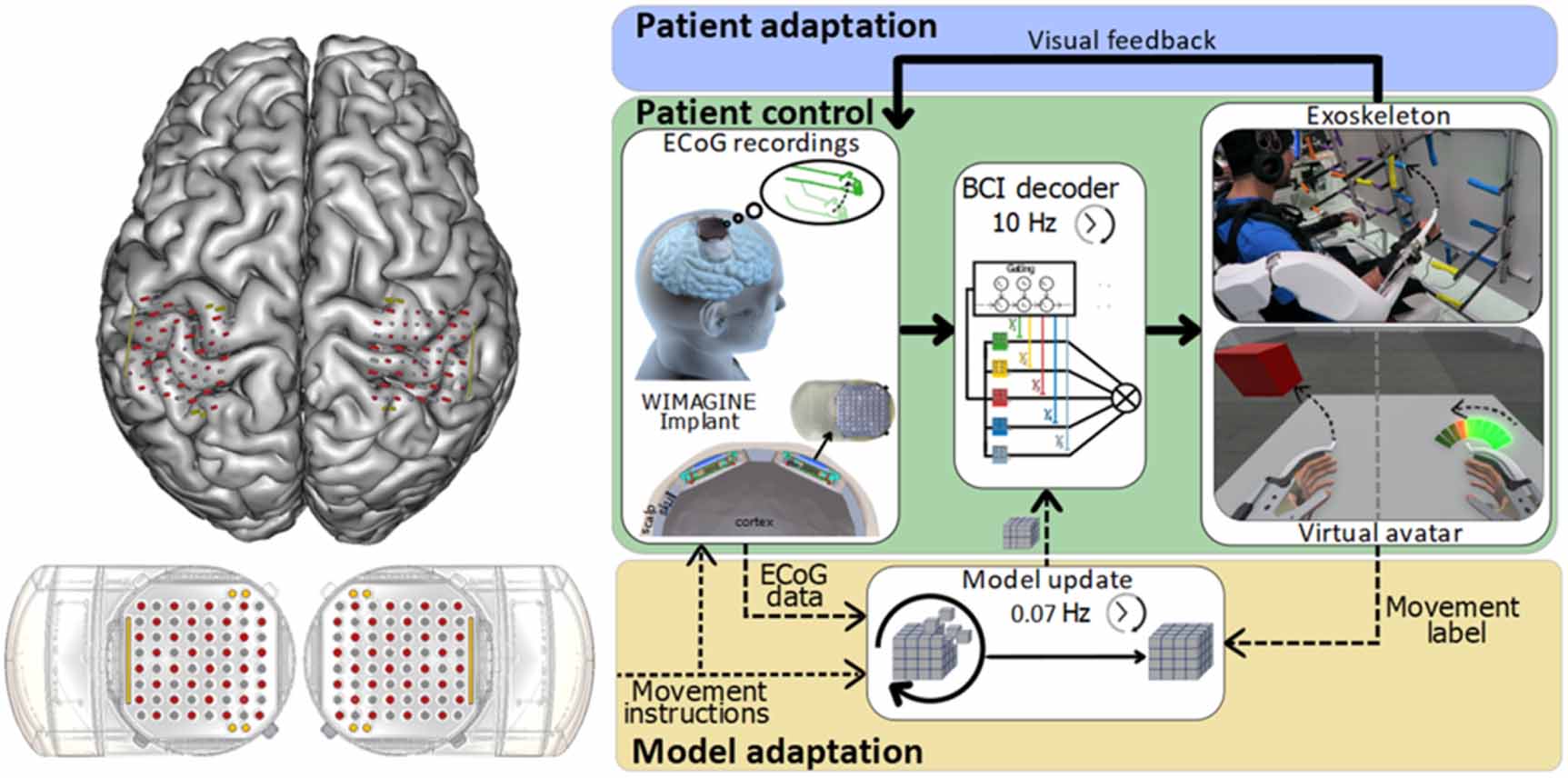 An adaptive closed-loop ECoG decoder for long-term and stable bimanual ...