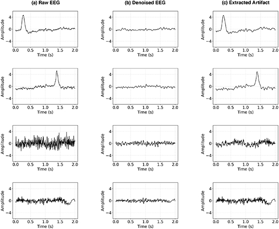 Embedding decomposition for artifacts removal in EEG signals - IOPscience