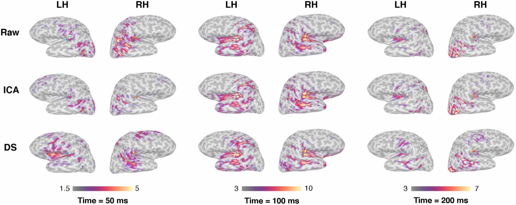 Embedding decomposition for artifacts removal in EEG signals - IOPscience