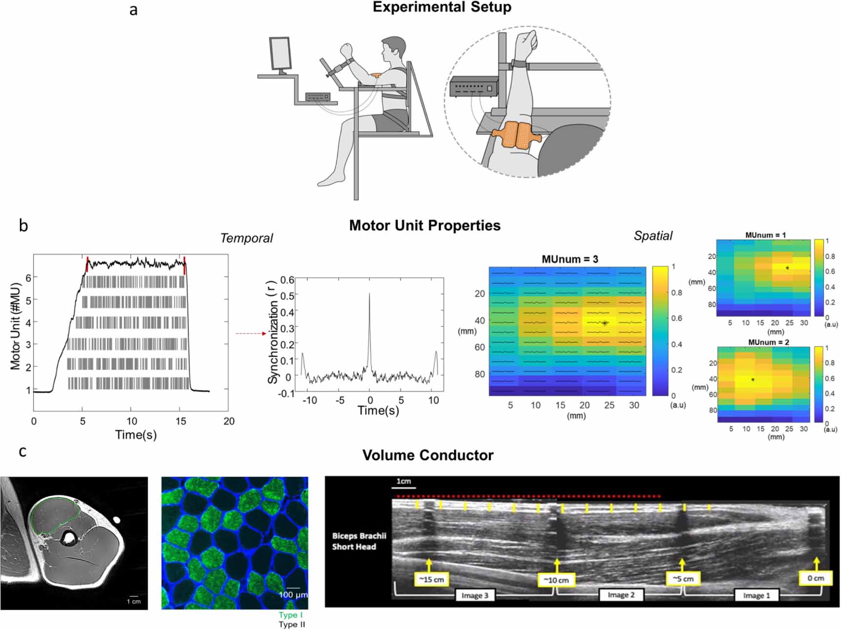 Neural decoding from surface high-density EMG signals: influence of ...