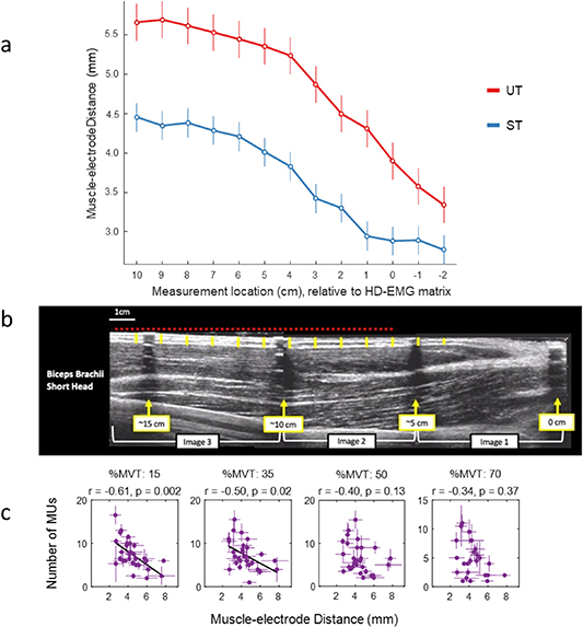 Neural decoding from surface high-density EMG signals: influence of ...