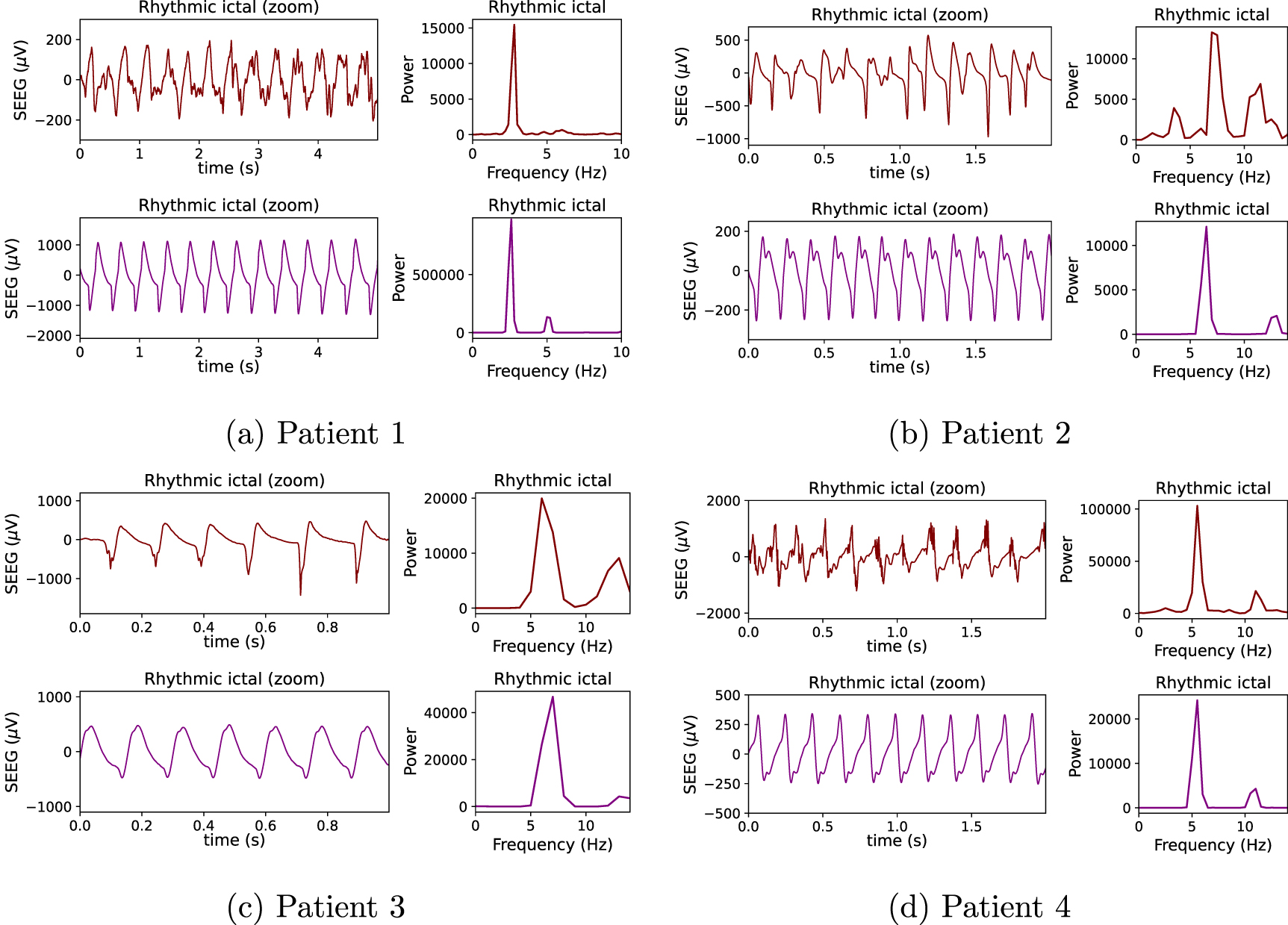 A personalizable autonomous neural mass model of epileptic seizures ...
