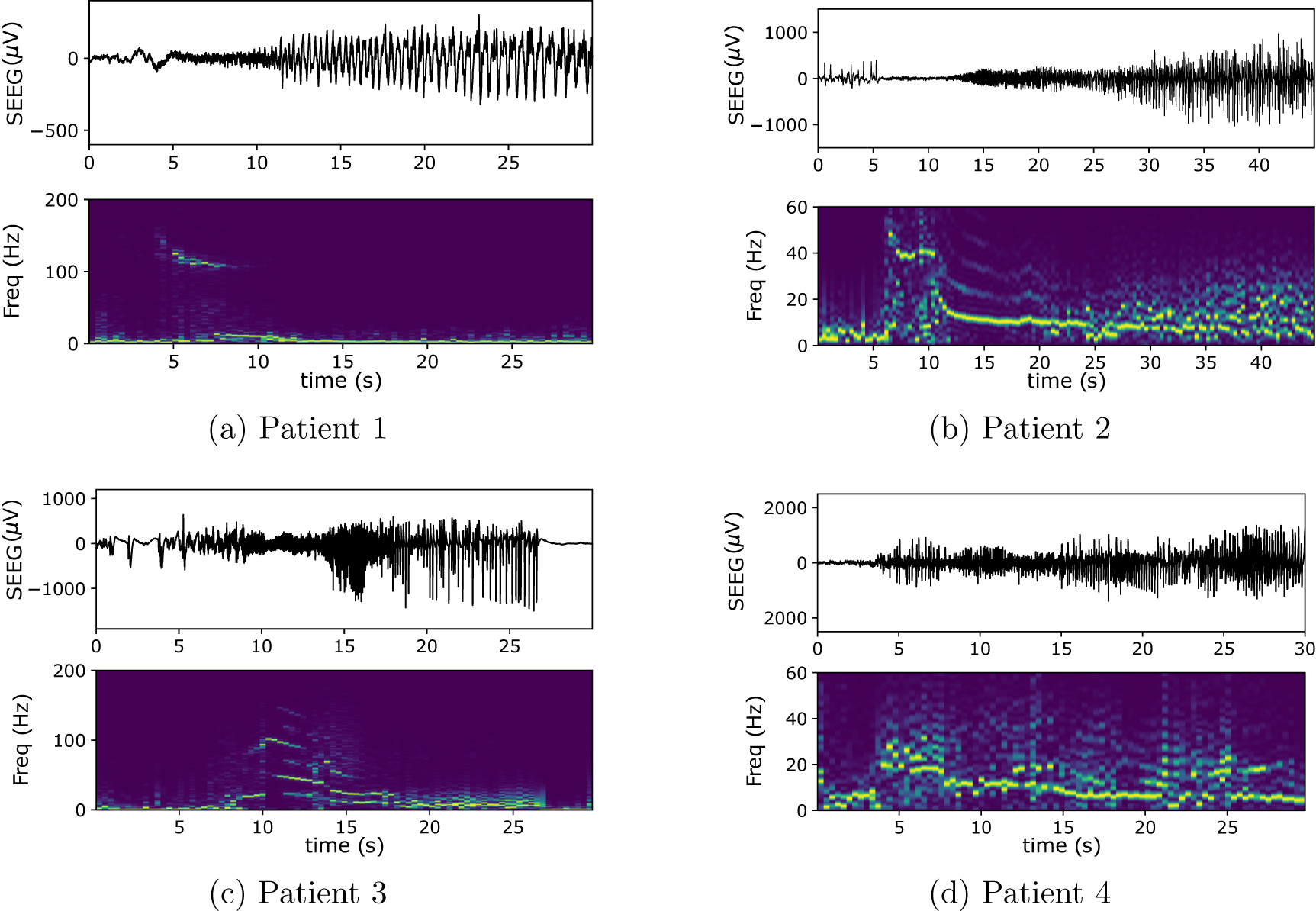 A personalizable autonomous neural mass model of epileptic seizures ...