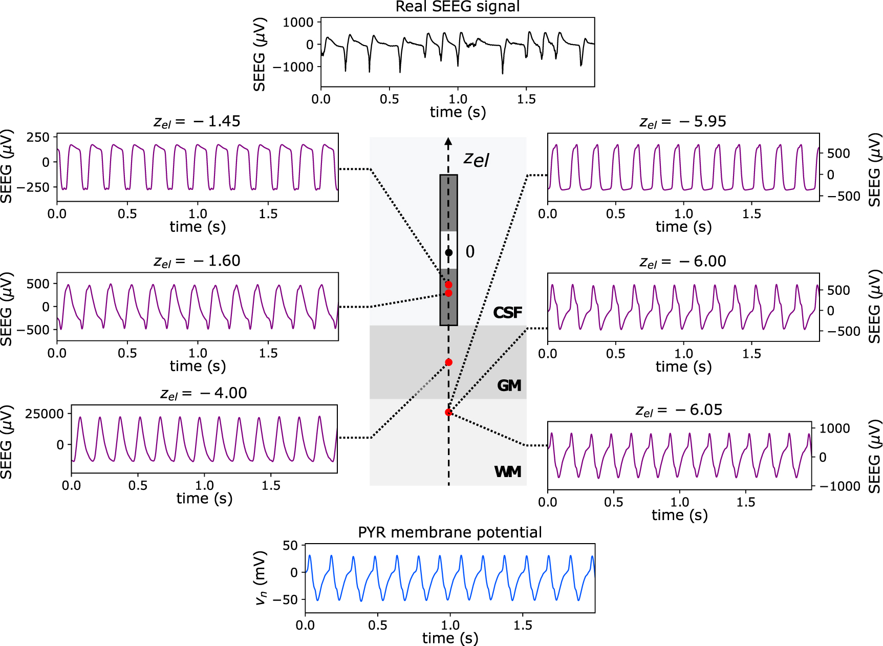 A personalizable autonomous neural mass model of epileptic seizures ...