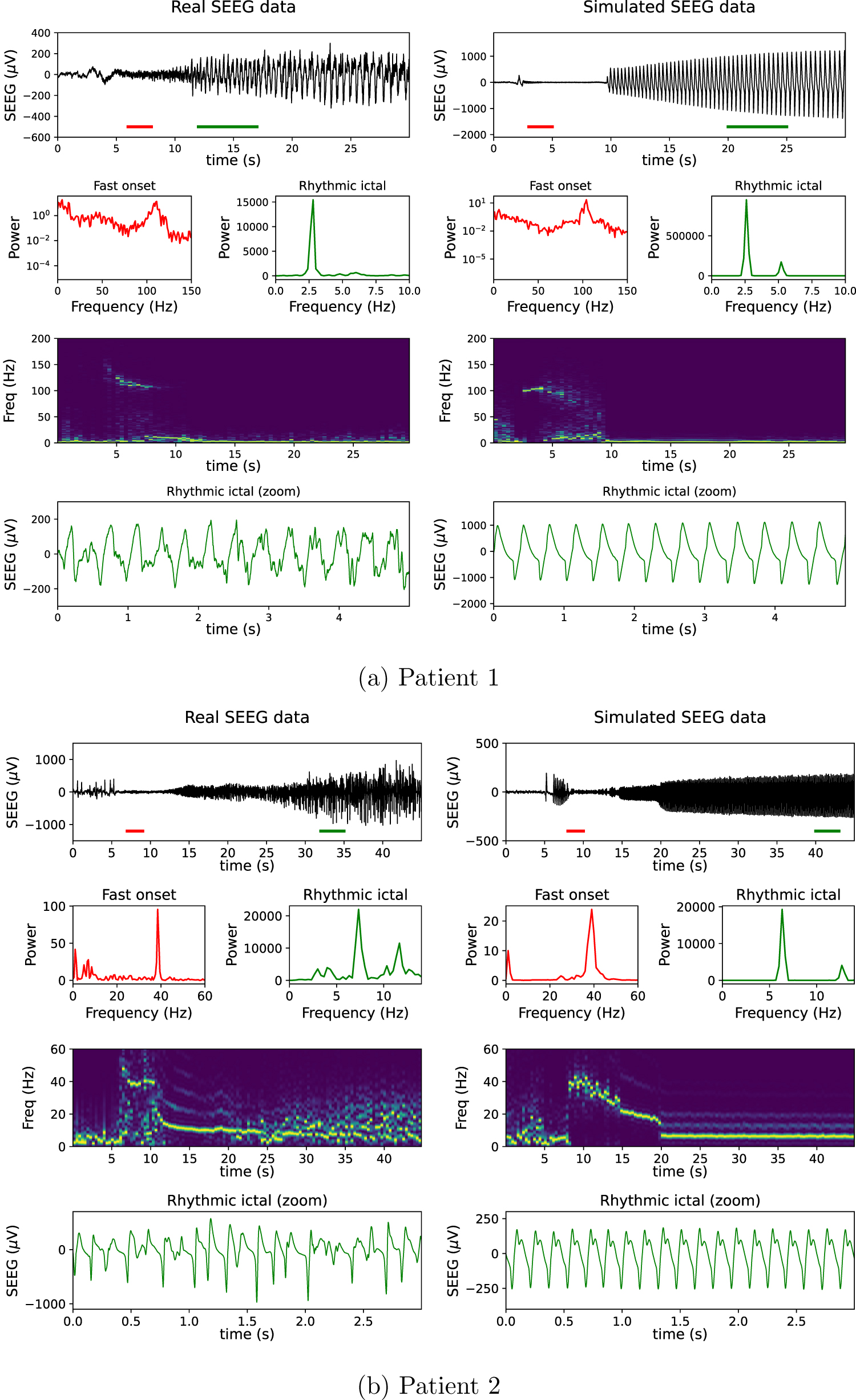 A personalizable autonomous neural mass model of epileptic seizures ...
