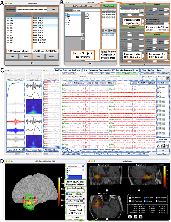 EMHapp: a pipeline for the automatic detection, localization and ...