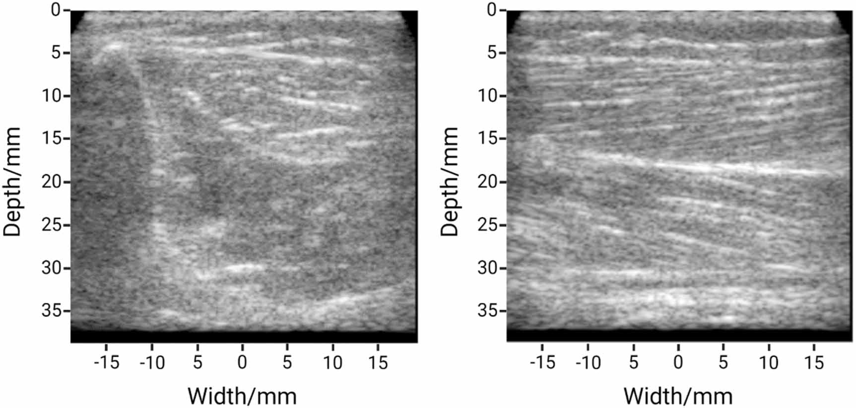 Kinematics of individual muscle units in natural contractions measured ...