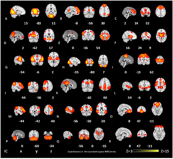 A sex-dependent computer-aided diagnosis system for autism spectrum ...