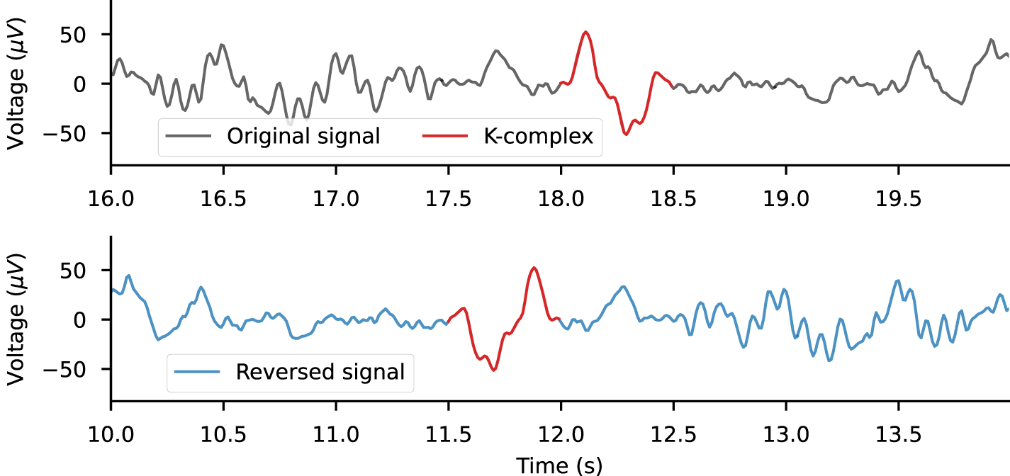 Data augmentation for learning predictive models on EEG: a systematic  comparison - IOPscience