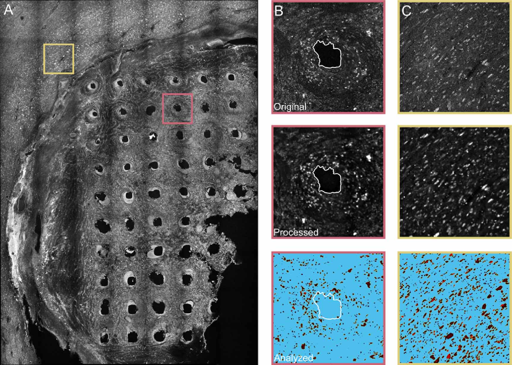 Utah array characterization and histological analysis of a multi-year ...