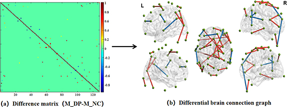 Analysis of functional connectivity in depression based on a weighted ...