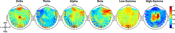 Functional connectivity based machine learning approach for autism ...