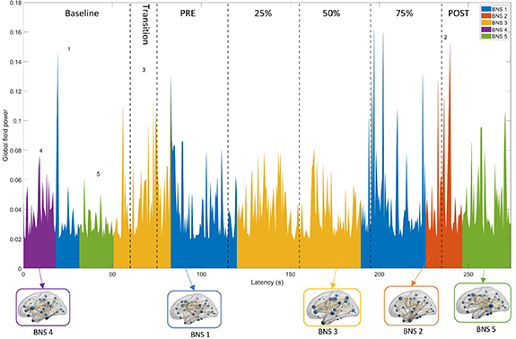 Brain network dynamics in the alpha band during a complex postural ...