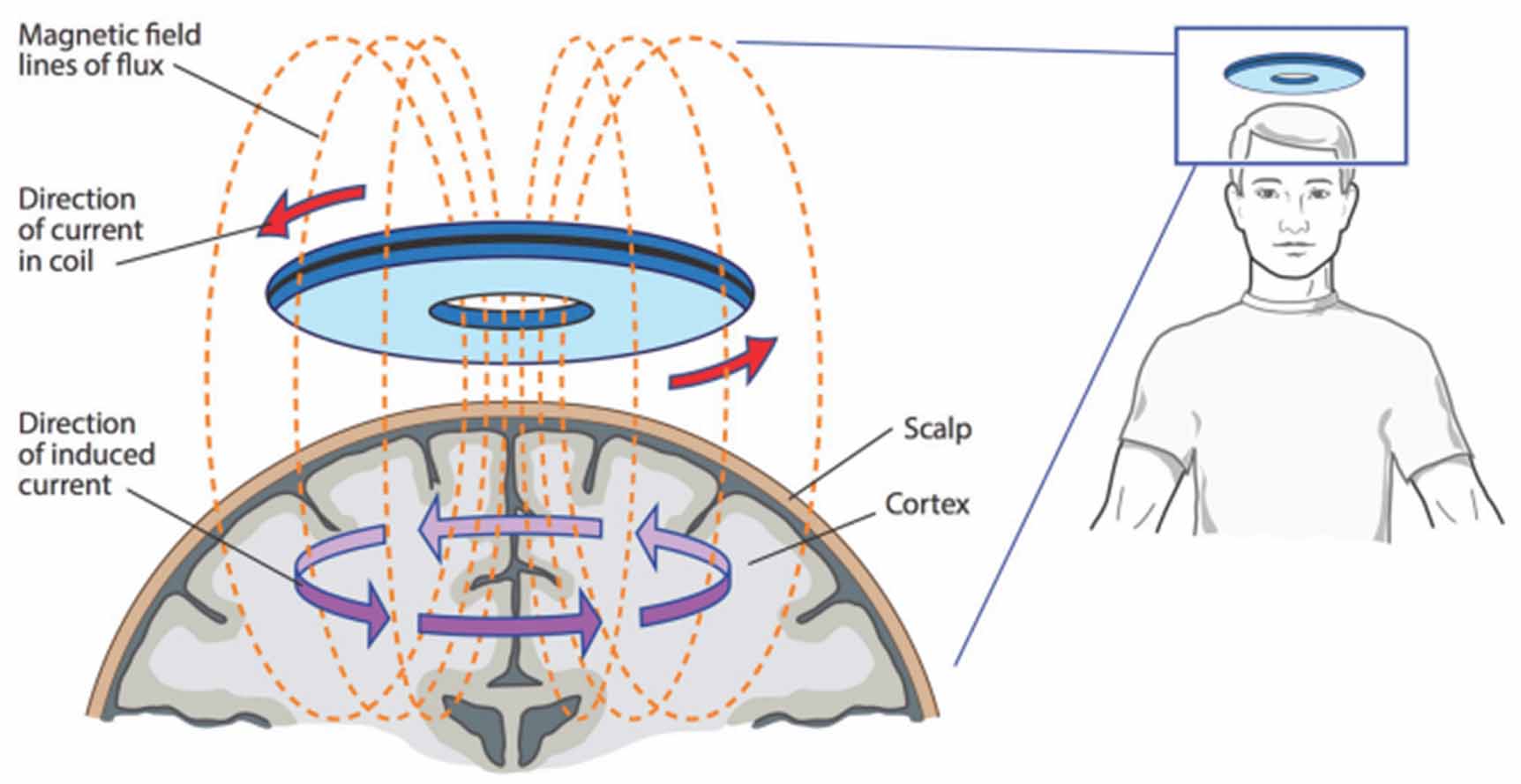 Modulating Neuron Physical mechanisms of emerging neuromodulation modalities - IOPscience