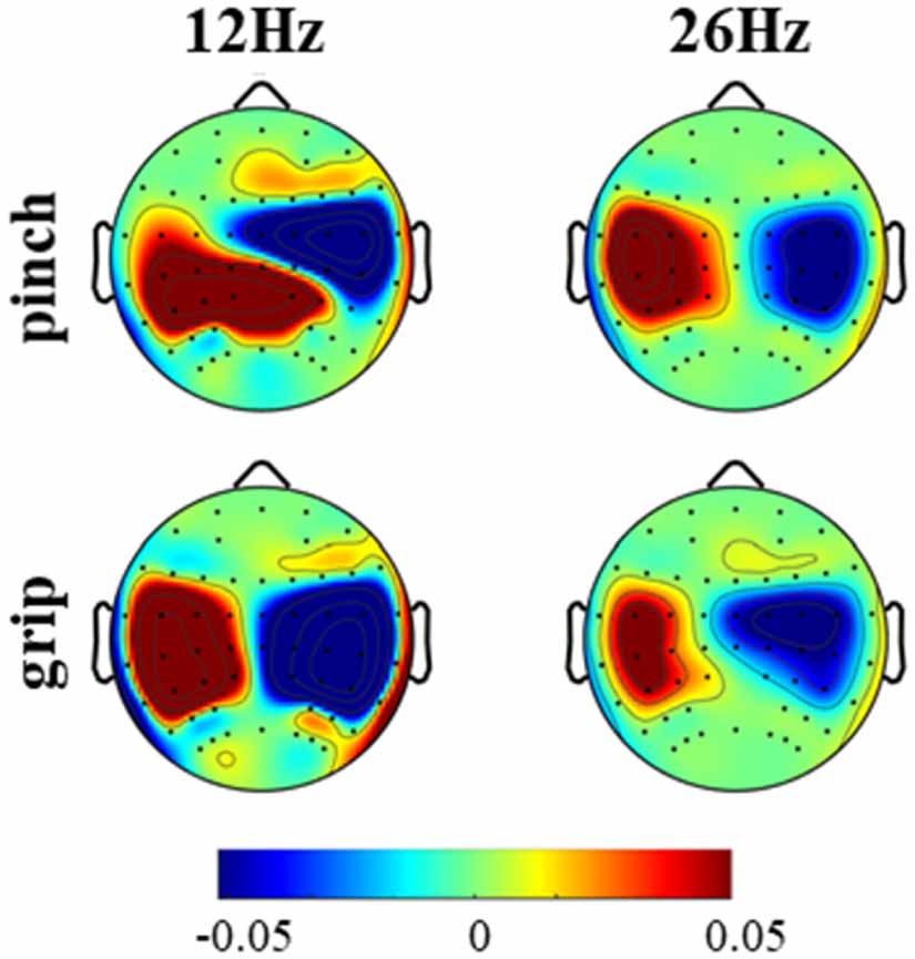 Enhancement of EEG–EMG coupling detection using corticomuscular ...