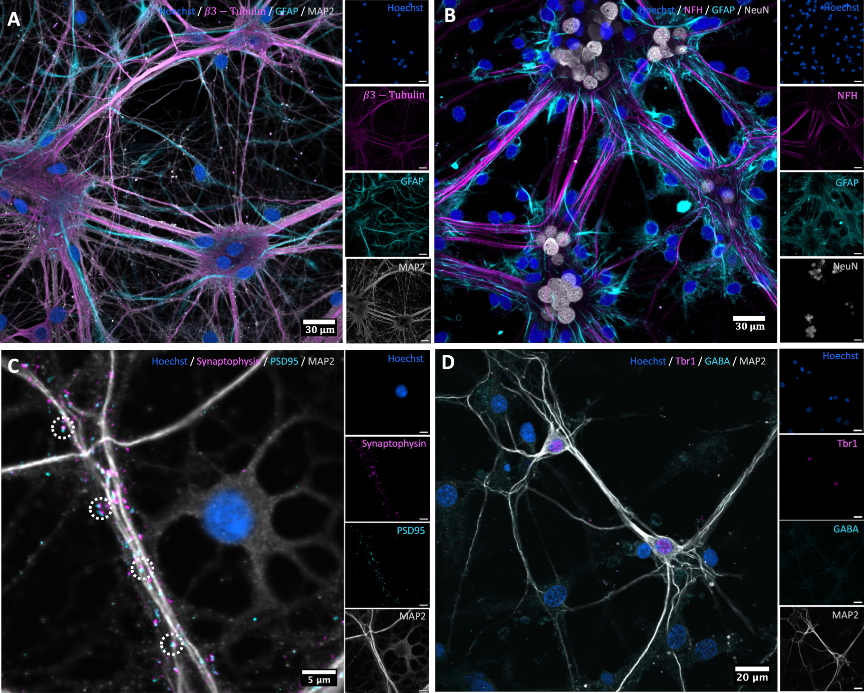 Structure-function dynamics of engineered, modular neuronal networks ...