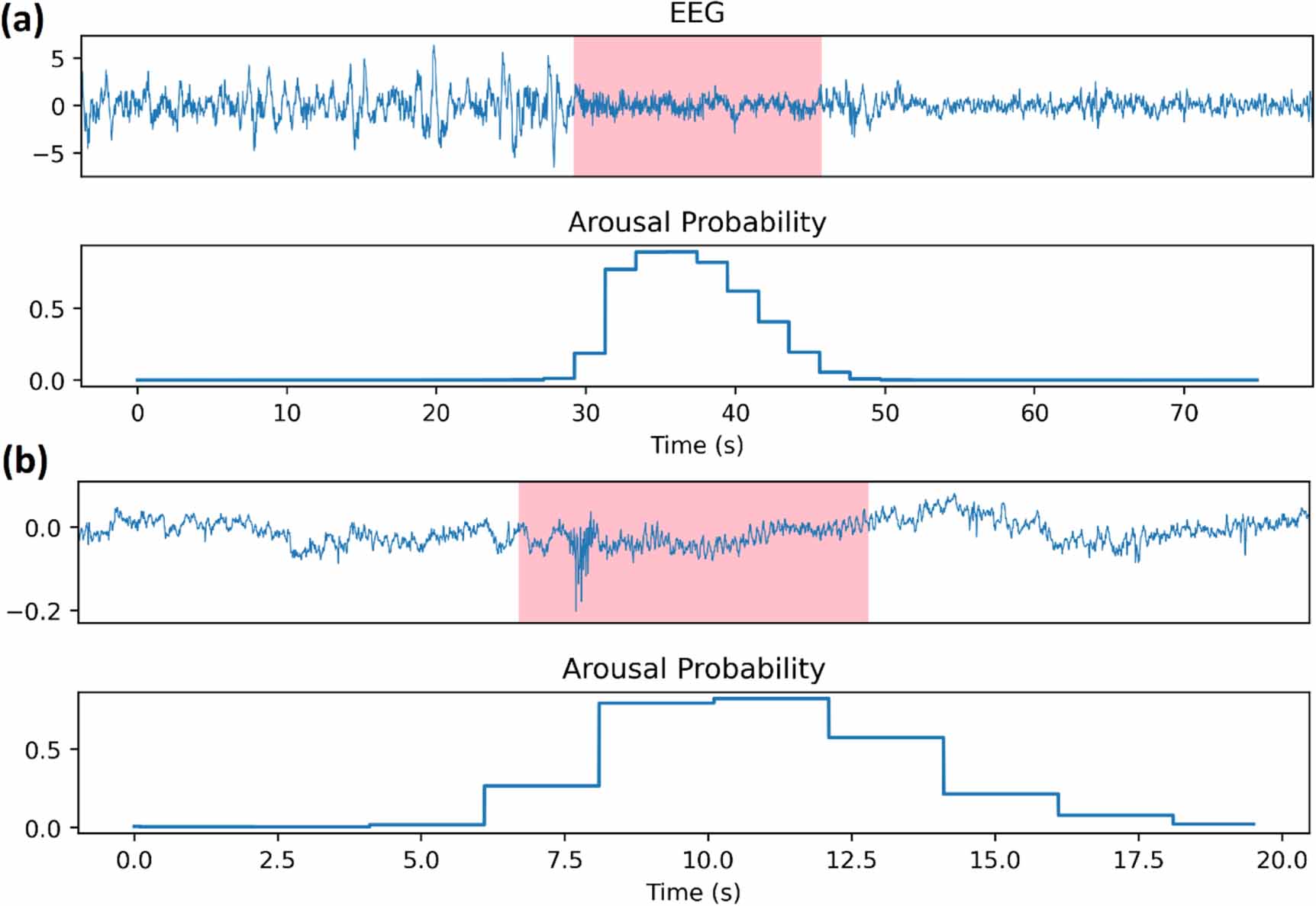 Multi-task learning for arousal and sleep stage detection using fully ...