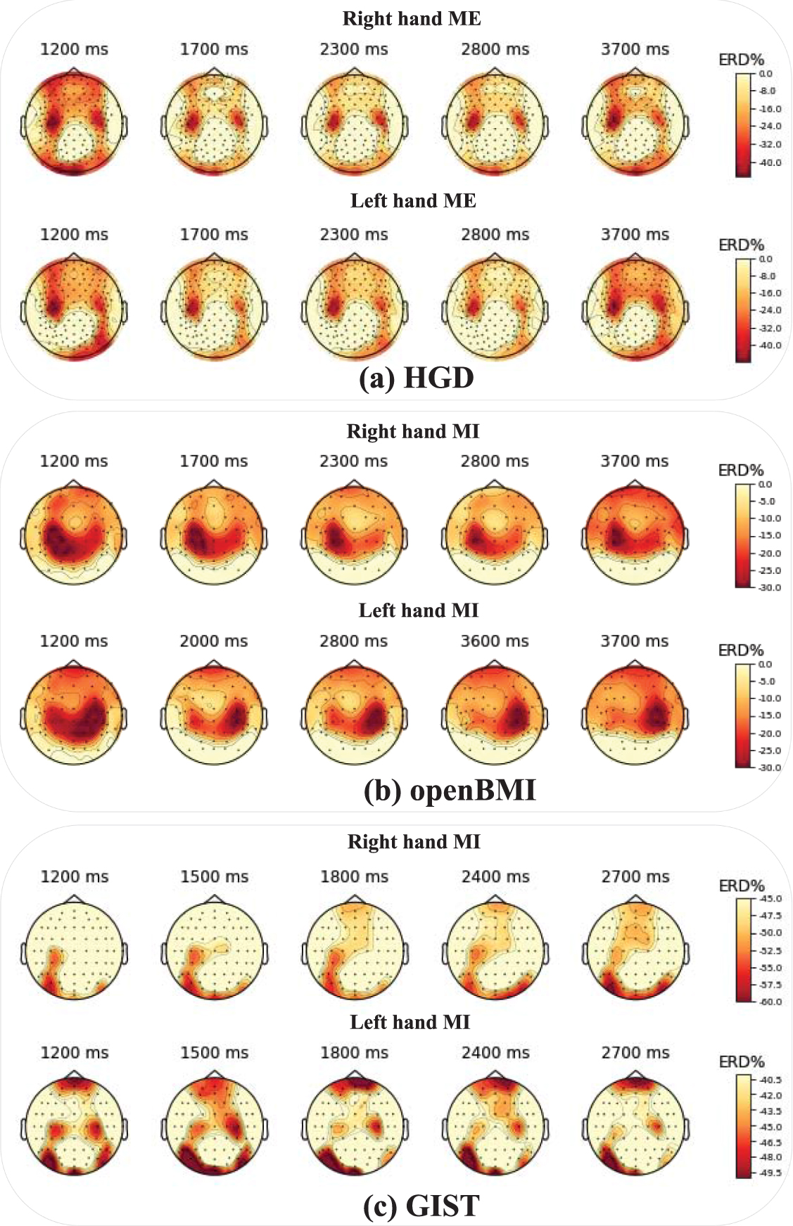 Explainable cross-task adaptive transfer learning for motor imagery EEG ...