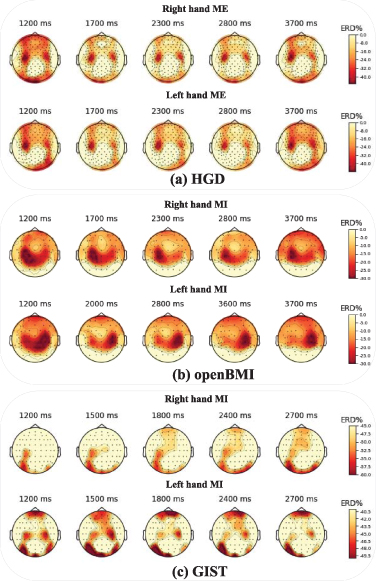Explainable cross-task adaptive transfer learning for motor imagery EEG ...