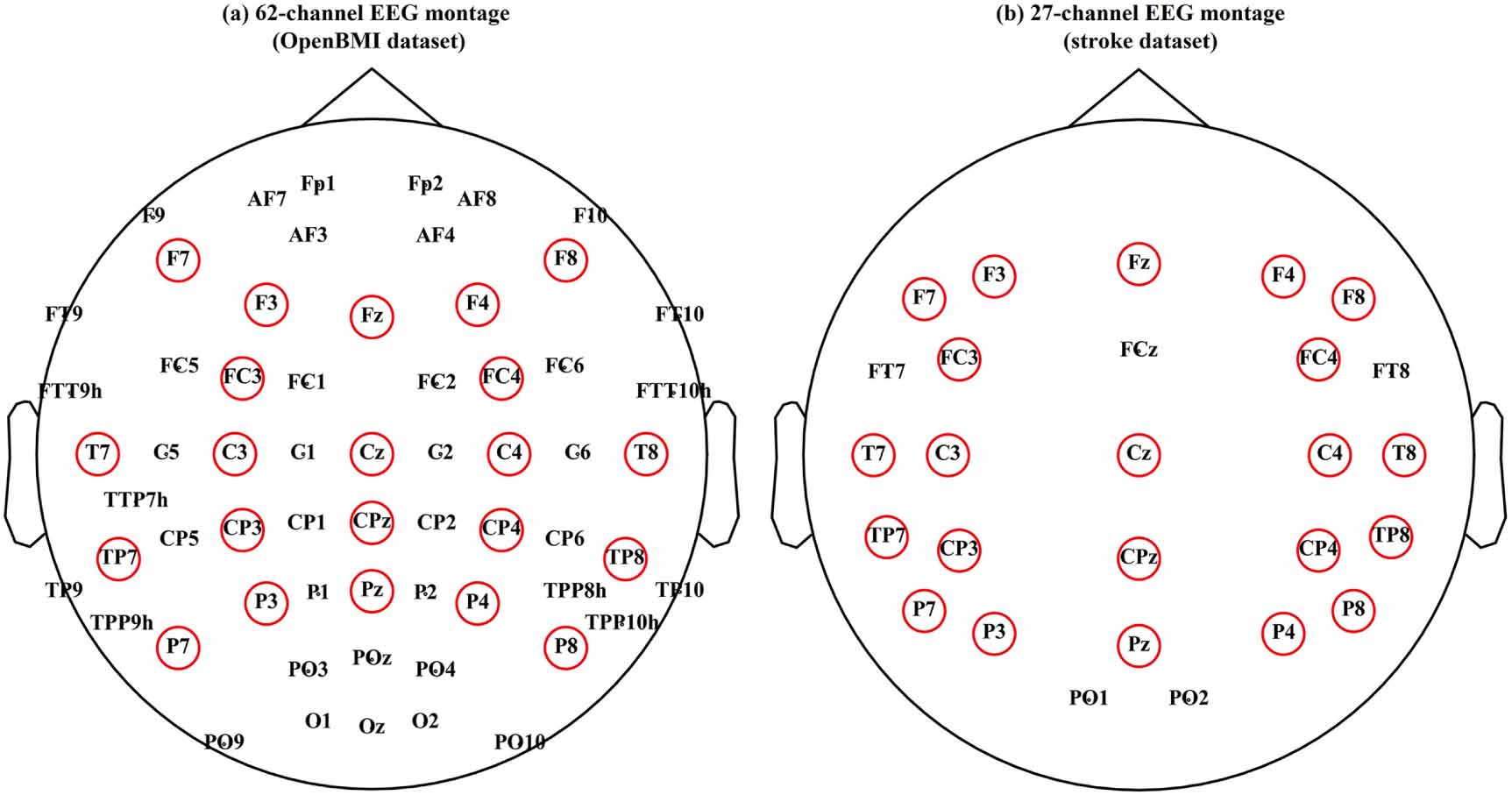 Transferring a deep learning model from healthy subjects to stroke ...