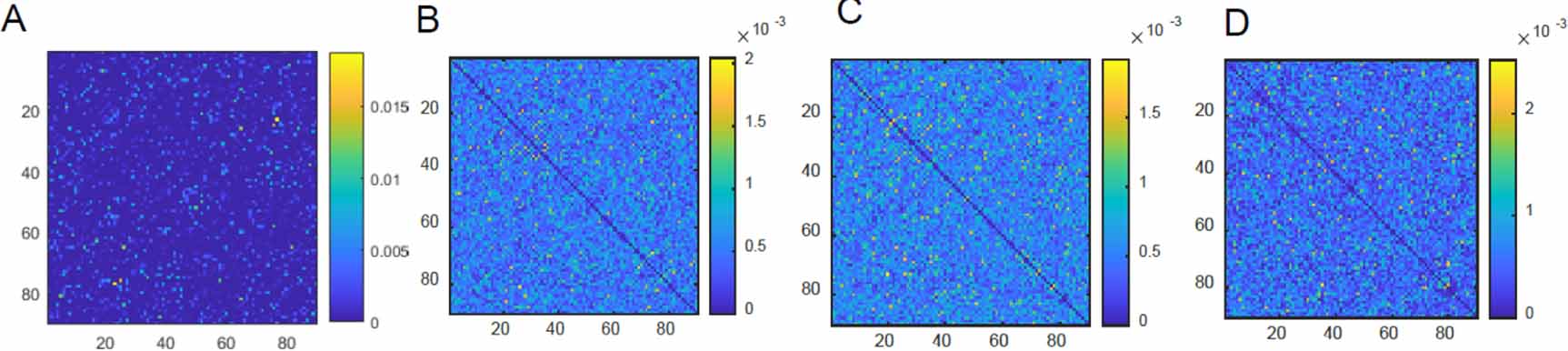 Brain connectivity patterns derived from aging-related alterations in ...