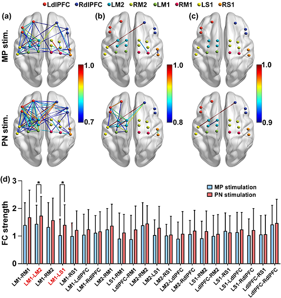 Comparison of the activation level in the sensorimotor cortex between ...