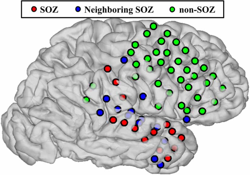 Seizure onset zone (SOZ) identification using effective brain ...