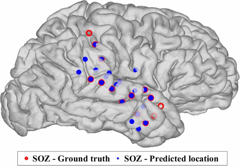 Seizure onset zone (SOZ) identification using effective brain ...